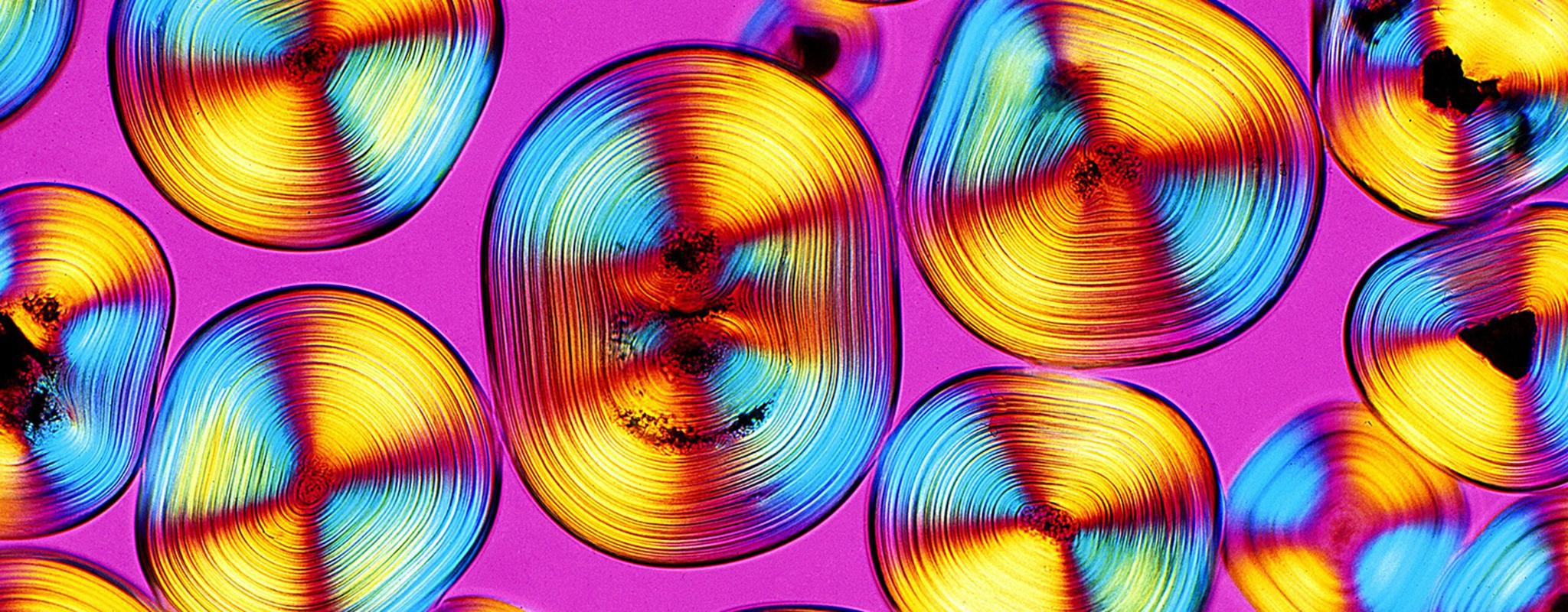 Light micrograph of bladder sand  by Spike Walker