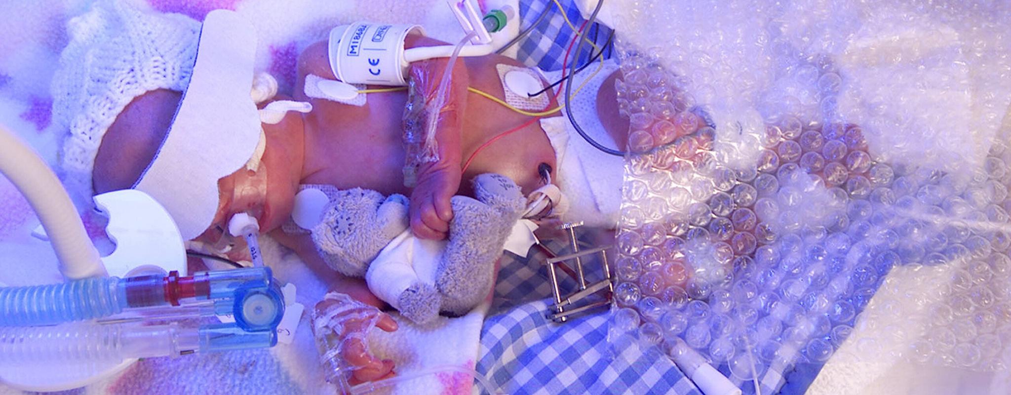 A photograph of a premature baby surrounded by medical equipment holding a teddy by Medical Illustration Department, Leicester Royal Infirmary.
