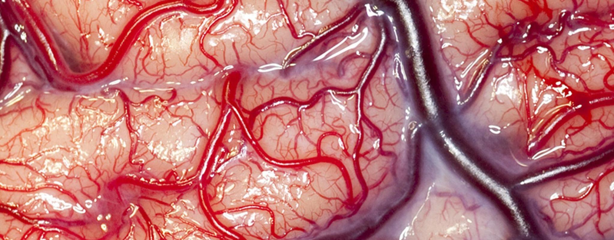 Overall winner for the 2012 Wellcome Image Awards. A photograph of the surface of a human brain belonging to an epileptic patient by Robert Ludlow, UCL Institute of Neurology, London.
