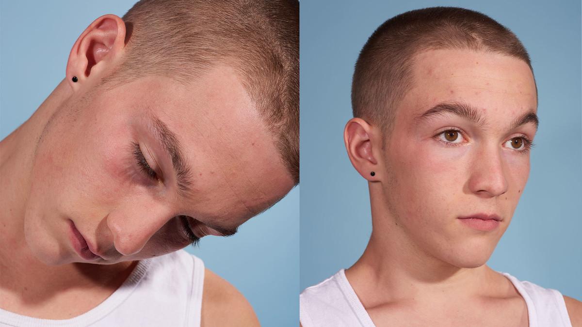 Two pictures of the same young boy with a shaved head. In one picture he is asleep, sitting up but with his head fallen onto his shoulder. In the other picture he is sat up right, wide awake.