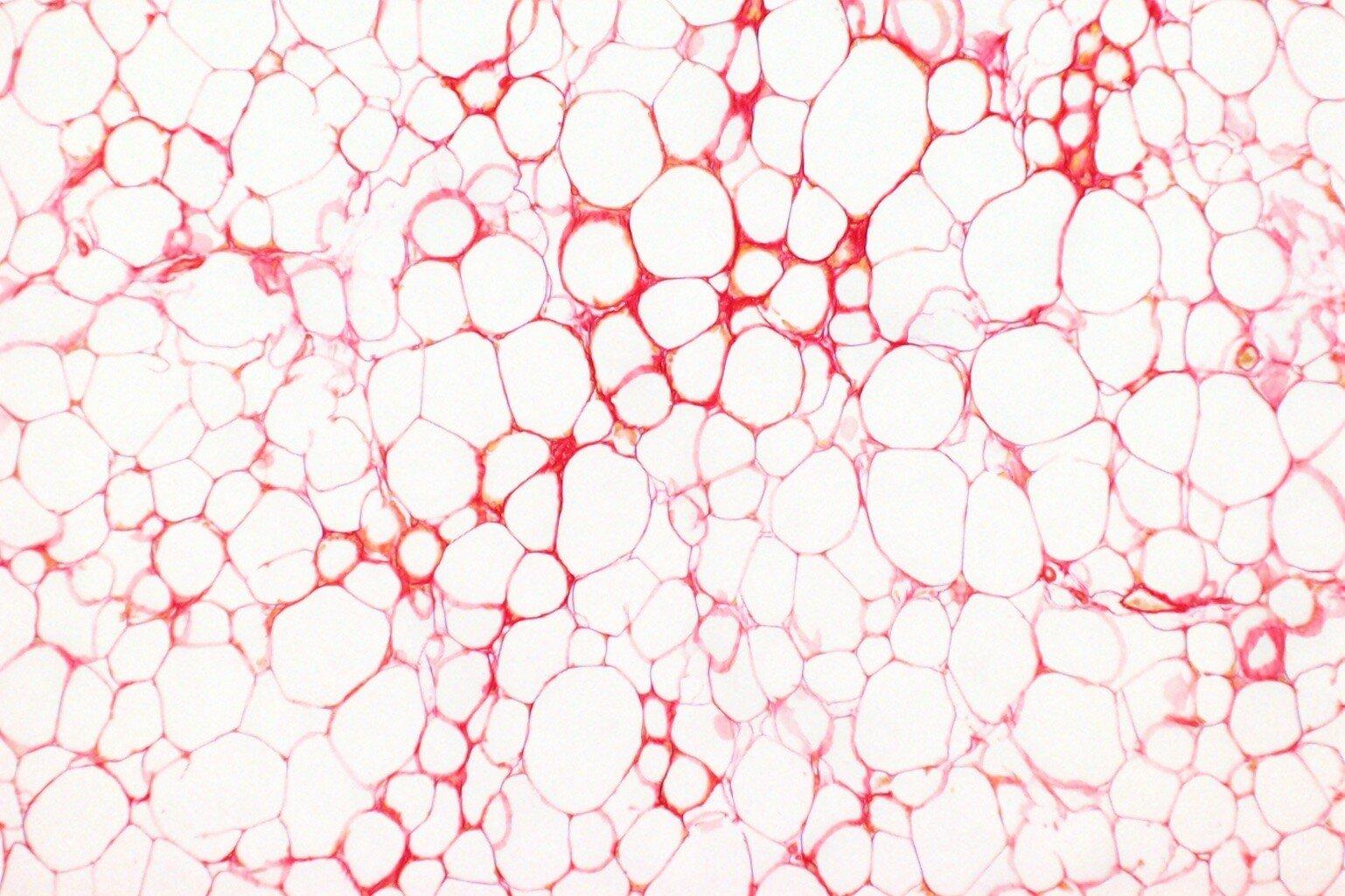 A microscopic image of adipose tissue shows hundreds of pinky red globular blobs.