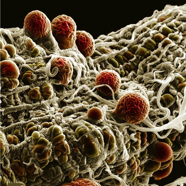 Electron micrograph of malaria parasites