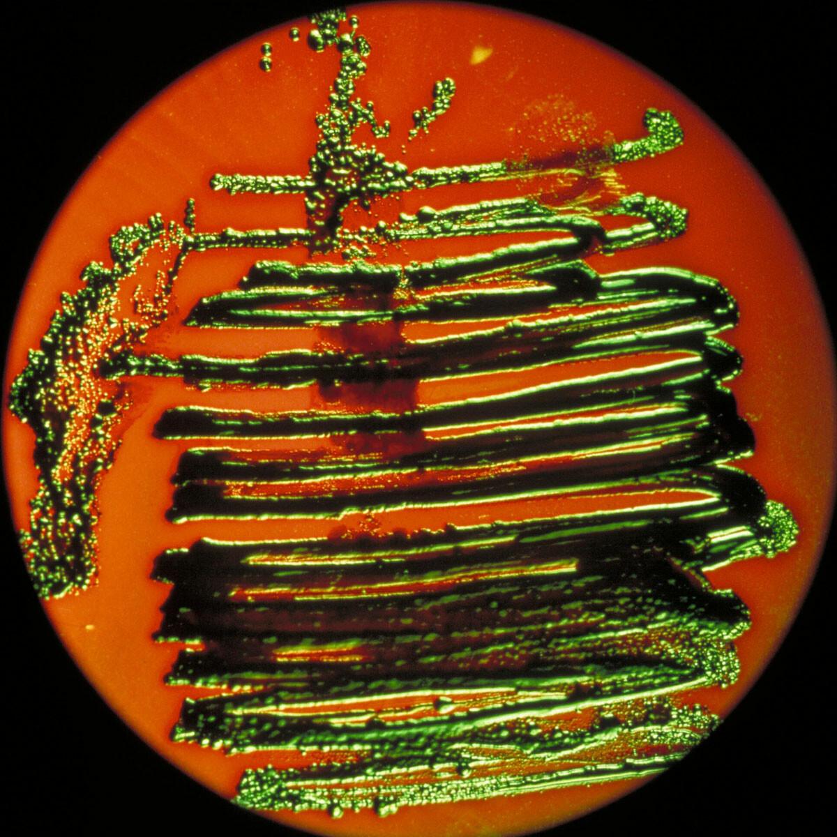 A petri dish covered with colonies of E. Coli